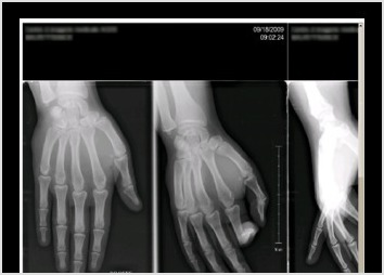 Conception d une gamme de logiciels d imagerie m�dicale, conception d IHM, test et contr�le qualit�. R�daction de cahier des charges, gestion de projets, organisation et coordination des travaux pour une �quipe de 9 d�veloppeurs, pilotage d un groupe de travail transversal sur l ergonomie des applications.